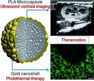 Photothermal therapy with theranostic agents